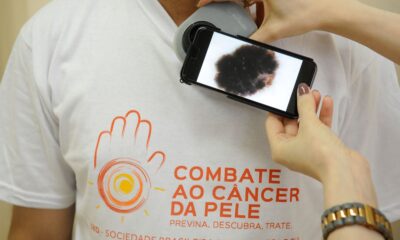 mutirao-atende-populacao-hoje,-no-dia-de-combate-ao-cancer-de-pele